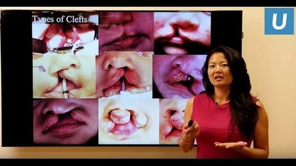 Dr. Justine Lee presenting cleft lip and palate care